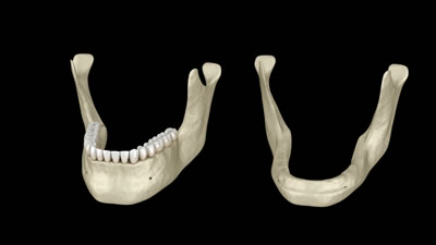 三鷹の歯医者｜ヒロ歯科クリニック｜武蔵境や吉祥寺からも通いやすい三鷹駅２分の歯科医院｜しっかり噛みたい・おいしく食べたい